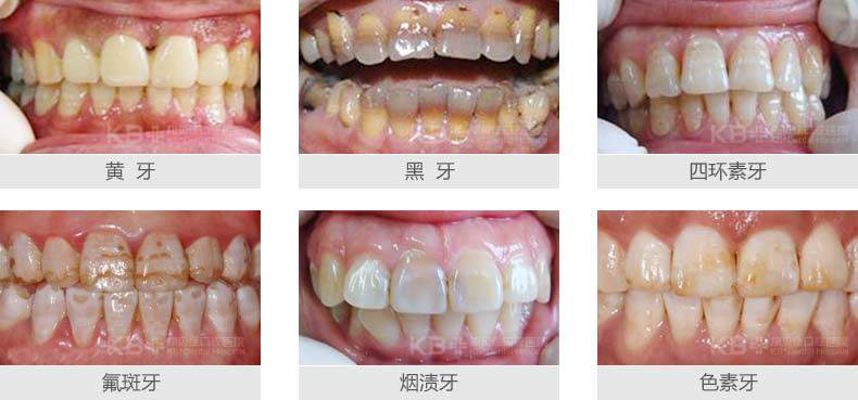 香港精准资料100