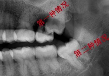 香港精准资料100